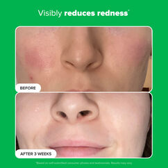 10% Azelaic Acid Booster, , large, image9