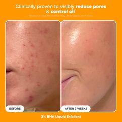 The Protect & Glow Kit, , large, image2