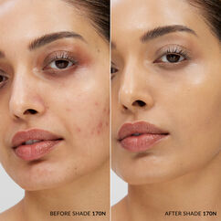 Skin Base, 170 N, large, image4