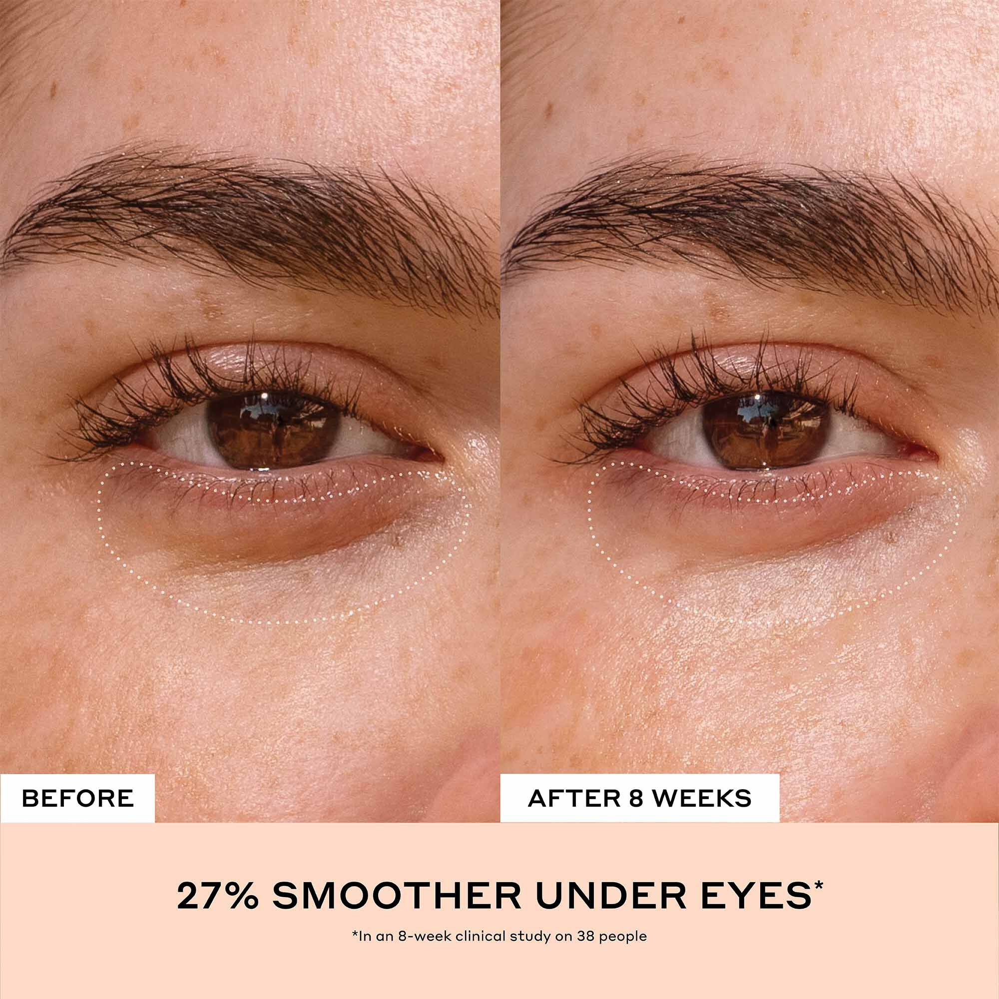 Ole henriksen eye cream discount