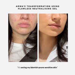 Flawless Neutralising Gel, , large, image4