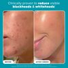 Skin Perfecting 2% BHA Liquid Exfoliant, , large, image5