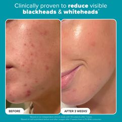 Skin Perfecting 2% BHA Liquid Exfoliant, , large, image5