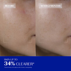 Daily Renewing Soft Peel, , large, image5