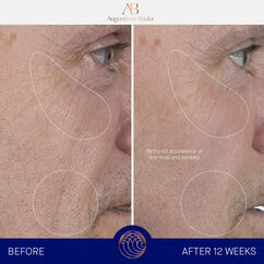 The Serum, , large, image5