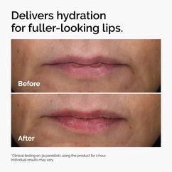 HA + Asiaticoside Lip Treatment, , large, image4