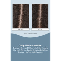 Scalp Revival Soothe and Detoxify Hair Care Minis, , large, image4