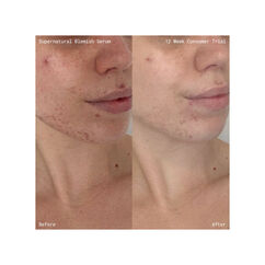 Supernatural Blemish Face Serum, , large, image8