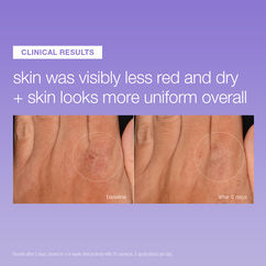Stabilising Repair Serum, , large, image5