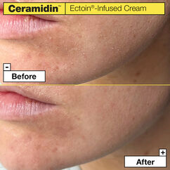 Ceramidin Infused Ectoin Cream, , large, image5