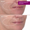 Heartleaf Gentle Resurfacing Serum, , large, image2