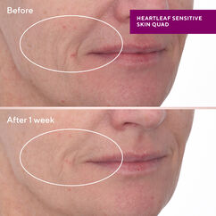 Heartleaf Gentle Resurfacing Serum, , large, image2