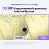 PDRN Lifting Pad, , large, image5