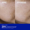 Daily Renewing Soft Peel, , large, image4