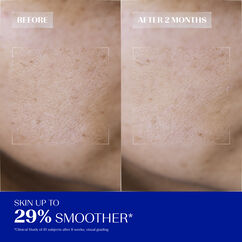 Daily Renewing Soft Peel, , large, image4