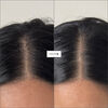 Scalp Revival&trade; Charcoal + Tea Tree Buildup Detox Spray, , large, image2