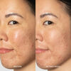 Glow2OH  Dark Spot Toner, , large, image6
