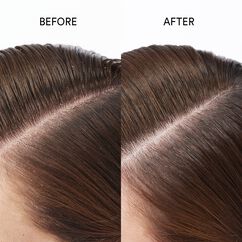Super Nature Scalp Restoring Oil, , large, image2