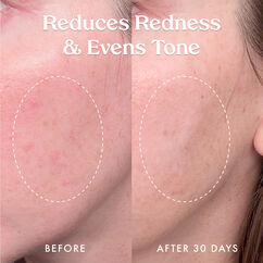 Star Bright Vitamin C Discolouration Correcting Serum, , large, image8