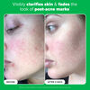 10% Azelaic Acid Booster, , large, image5
