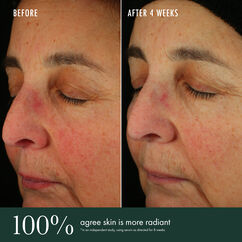 Brightening Serum, , large, image9