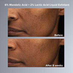 6% Mandelic Acid + 2% Lactic Acid Liquid Exfoliant, , large, image8