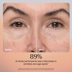 TheraFace PRO- Black, , large, image3