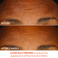 Extra Strength Daily Peel, , large, image11