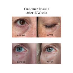 Eye Wonder Nutri-Active Eye Serum, , large, image4