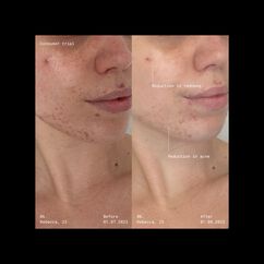 Supernatural Blemish Face Serum, , large, image8