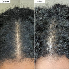 Scalp Revival&trade; Charcoal + Coconut Oil Micro-exfoliating Shampoo, , large, image3
