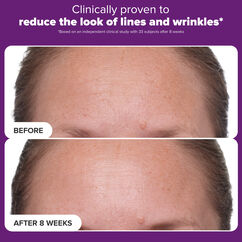 1% Retinol Treatment, , large, image5