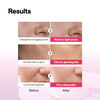 Rose PDRN Essential Mask Healthy Glow, , large, image5