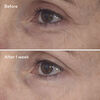 Retinal ReSculpt™ Eye Treatment, , large, image6