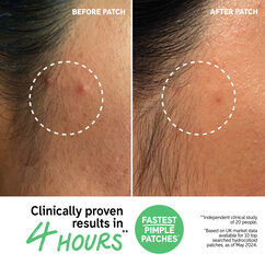 Hydrocolloid Invisible Pimple Patches, , large, image4