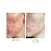 Violet Water Clearing Cleanser Blemish Control Facial Cleansing Gel, , large, image7