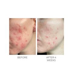 Violet Water Clearing Cleanser Blemish Control Facial Cleansing Gel, , large, image7