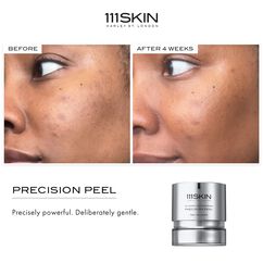 Precision Peel, , large, image5