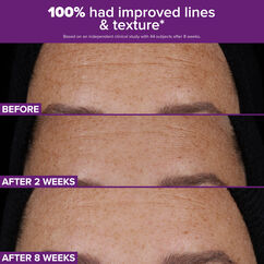 Clinical Pro Retinaldehyde Dual-Retinoid Treatment, , large, image9