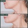 Fermitif Chin Contour Mask Instant Tightening Peptide Mask, , large, image7