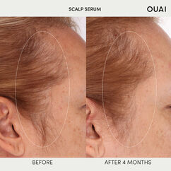 Scalp Serum, , large, image2