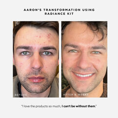 Radiance Kit, , large, image5