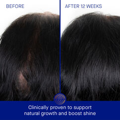 The Scalp Treatment, , large, image5