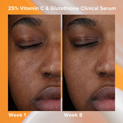 25% Vitamin C + Glutathione Clinical Serum, , large, image6
