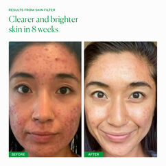 Skin Filter, , large, image7