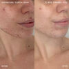 Supernatural Blemish Face Serum, , large, image8