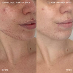 Supernatural Blemish Face Serum, , large, image8