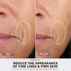 CryoGlow Under-Eye Cooling & LED Anti-Ageing & Blemish Repair Mask - Strawberry Matcha, , large, image2