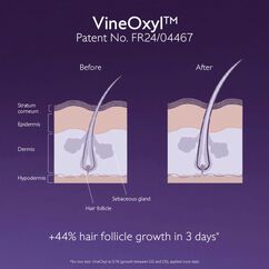 Anti-Hair Loss Serum, , large, image8