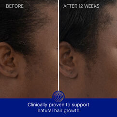 The Scalp Treatment, , large, image4